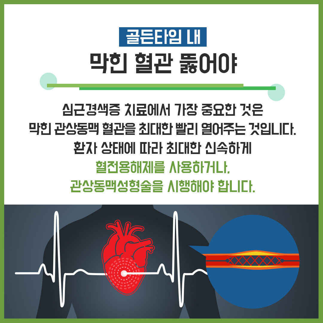 심근경색5.jpg