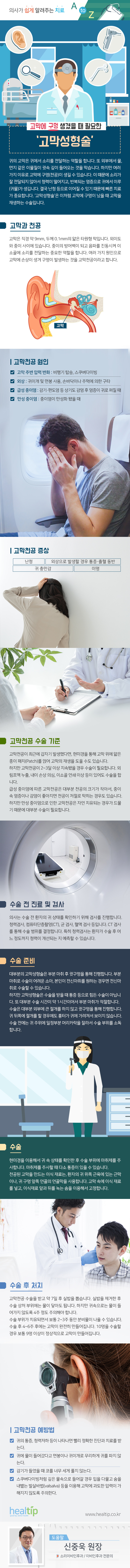 180720_고막에 구멍 생겼을 때 필요한 ‘고막성형술’.jpg