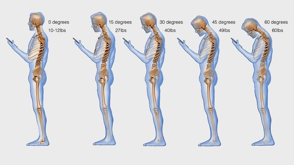 목을 60도 숙이면 목뼈에는 27kg에 달하는 하중이 가해진다 ©️ Spine Wellness Center