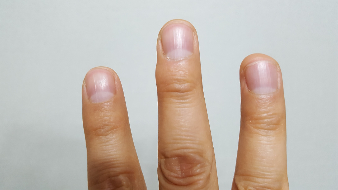 180423-2 20171127_222330.jpg