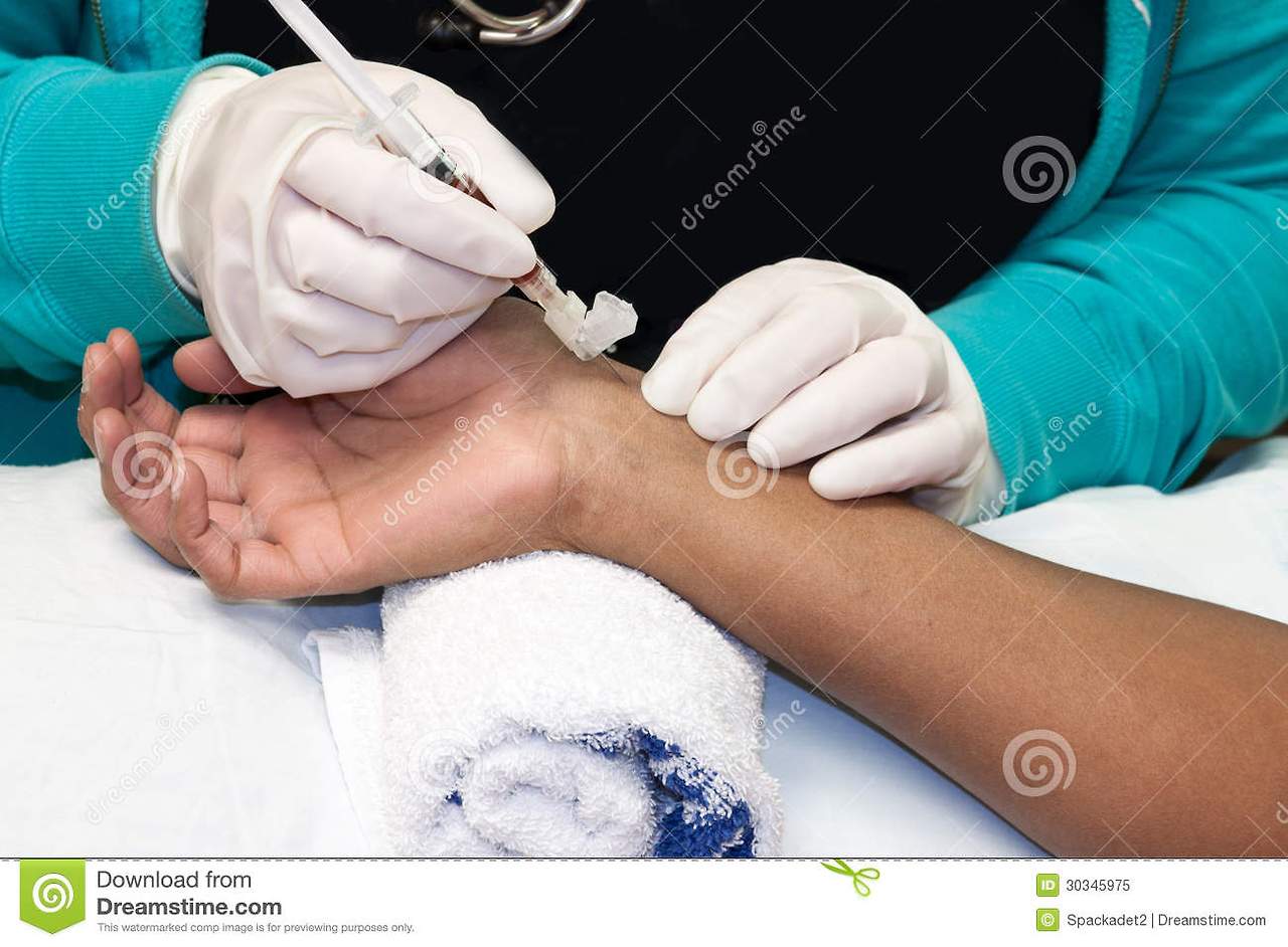 arterial-puncture-blood-sample-being-drawn-dark-skinned-female-30345975.jpg