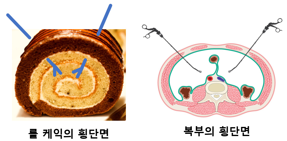 복부의 횡단면.jpg