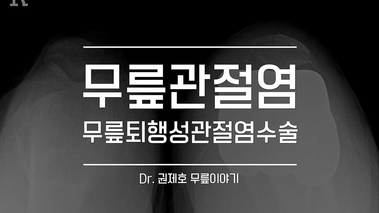 퇴행성관절염 인공관절 수술 과정 (6).jpg