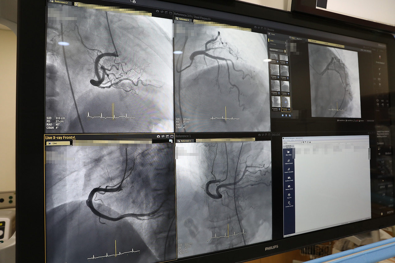 심아주리온 도입_관상동맥조영술1.jpg