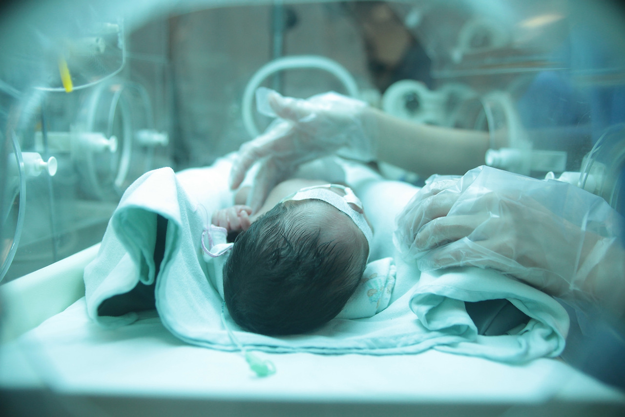 [사진] 중증 신생아 치료 이미지.jpg