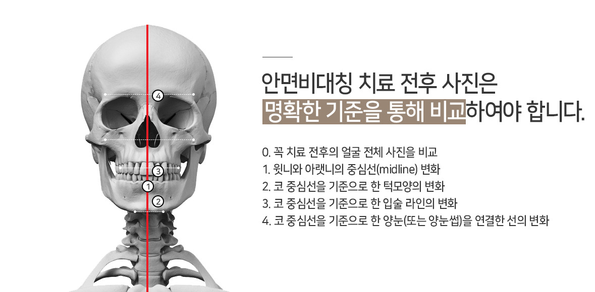 대구안면비대칭3.jpg