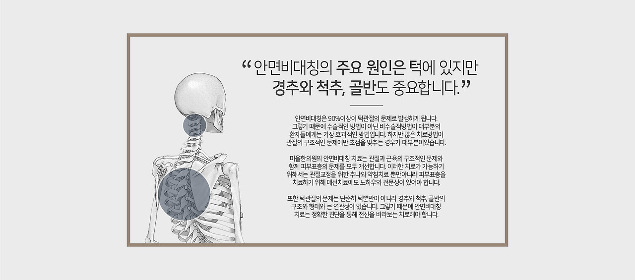 대구안면비대칭6.jpg