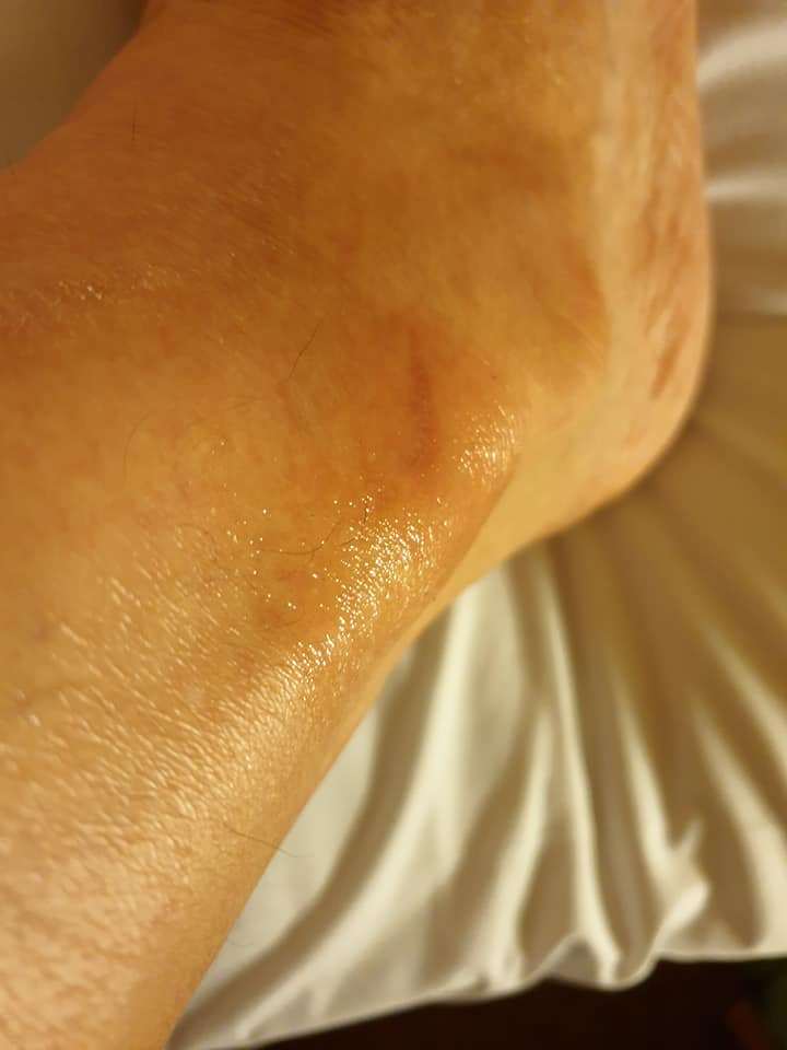 몽블랑 발목 잡히기.jpg