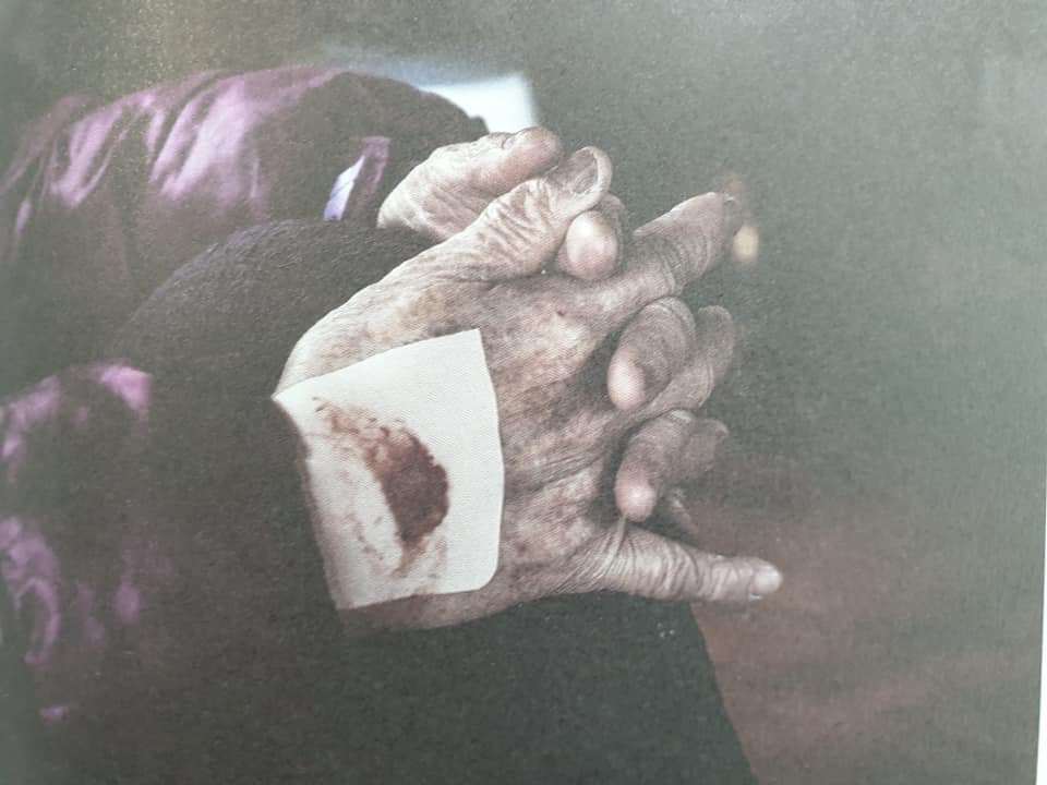 할머니 상처.jpg