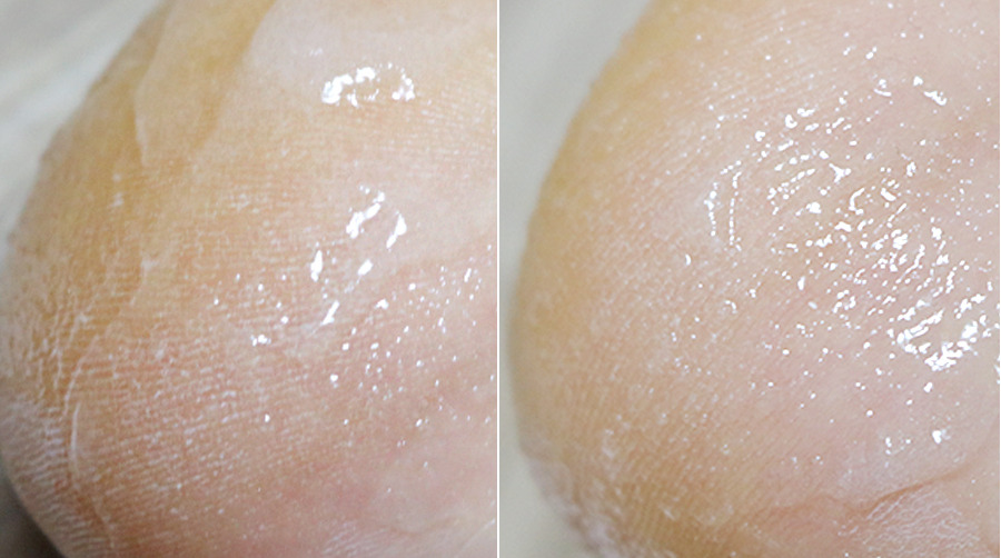 발 각질제거 0510.jpg