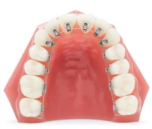 2_설측교정 (3).jpg