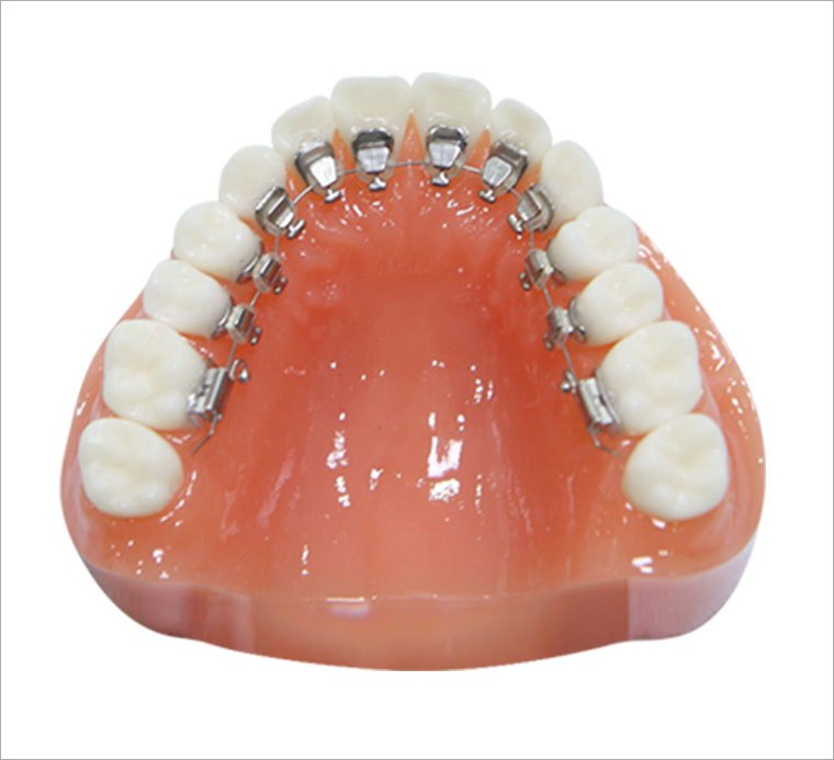 2_설측교정 (1).jpg