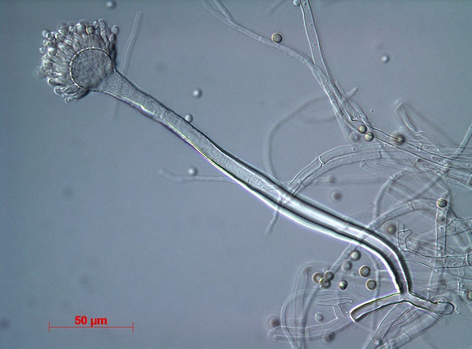 황국균 광학현미경 사진.jpg