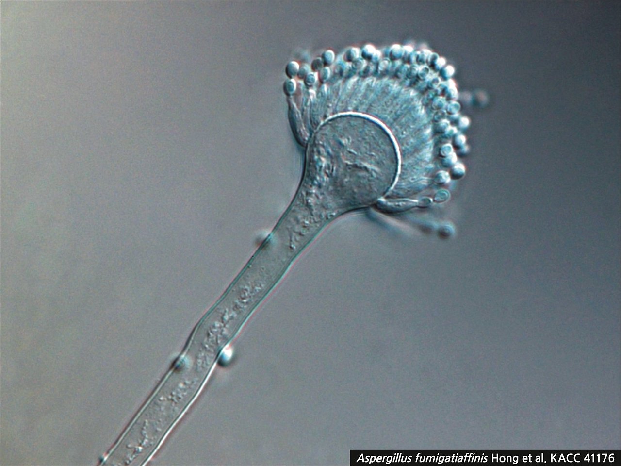 Aspergillus 현미경 사진.jpg