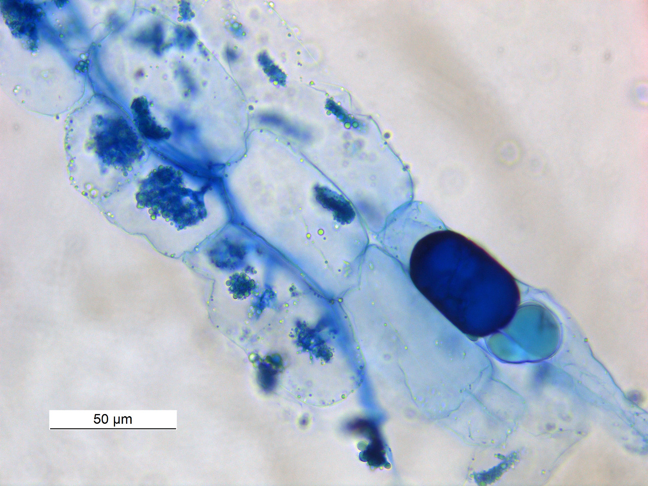 Vesicular_Arbuscular_Mycorrhizae_40X0031_03.jpg