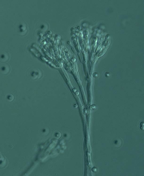 Conidiophore.jpg