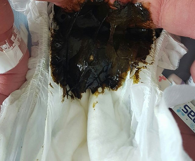 meconium_poo.jpg