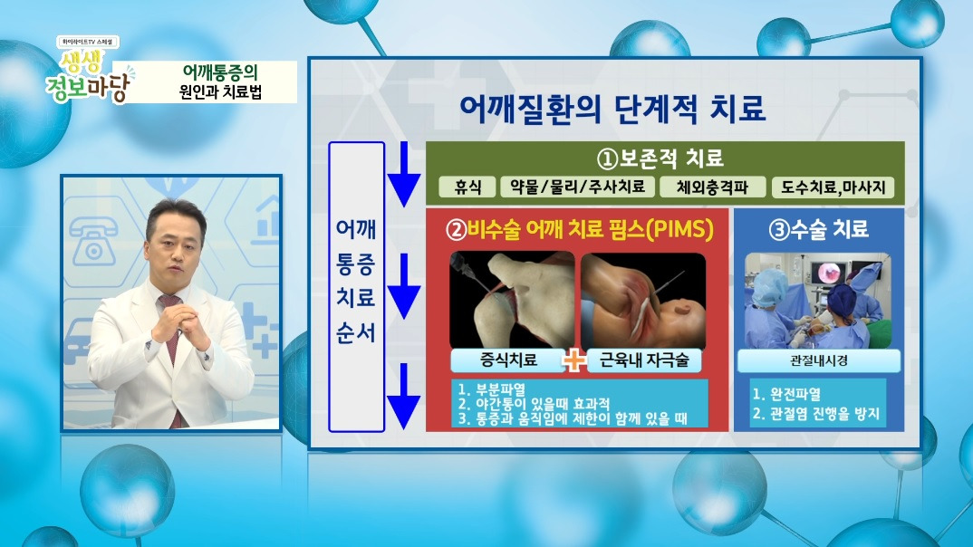 어깨질환 단계적 치료소개.jpg
