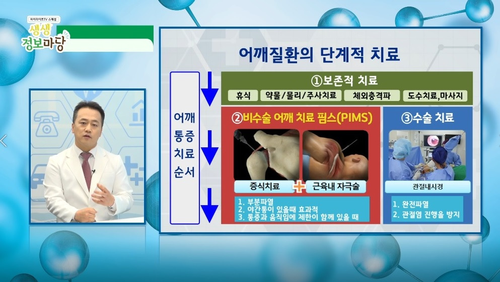 어깨질환 단계치료방법.jpg