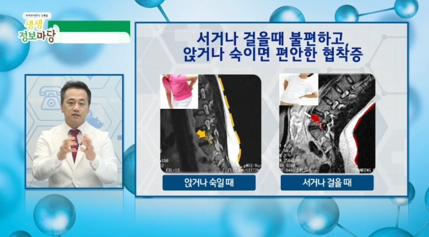 서거나 걸을때.jpg