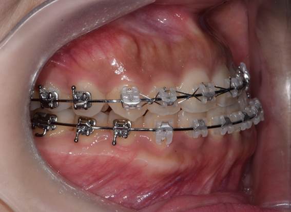 구내 우측모.jpg