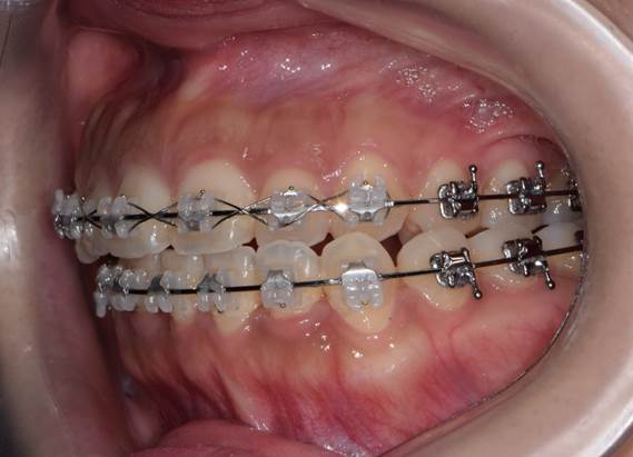 구내 좌측모.jpg