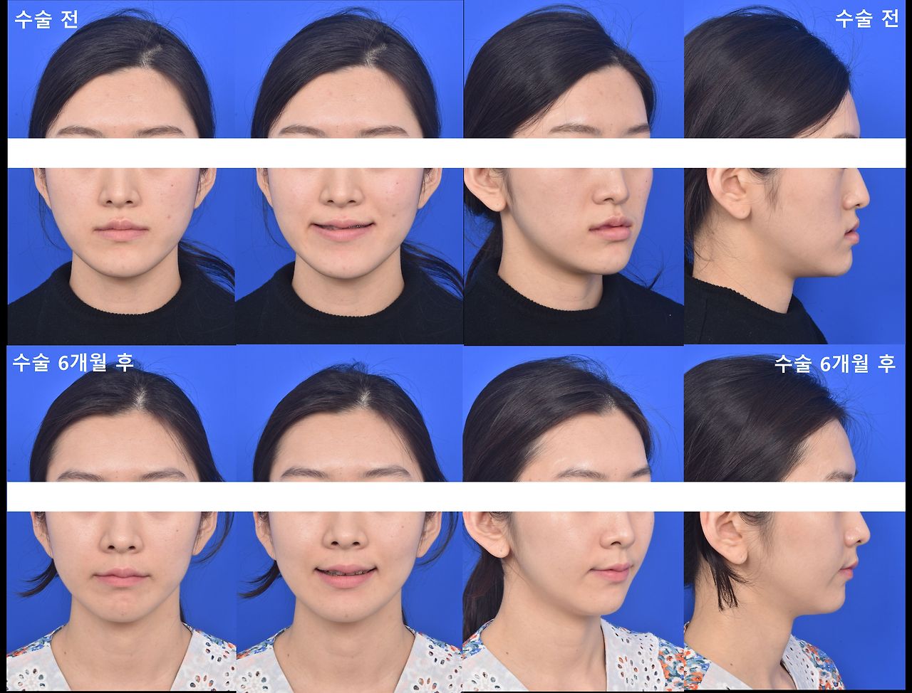 2. 임나현-1_jpg.jpg