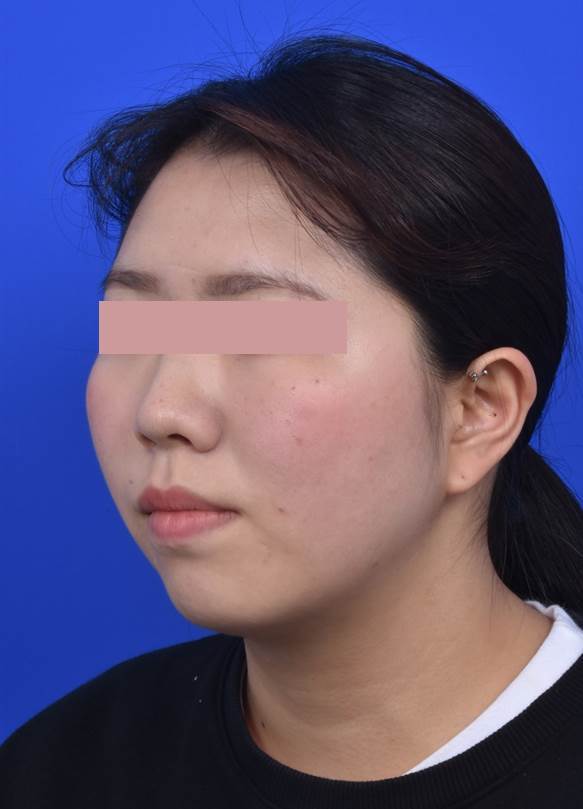 술전 좌측모.jpg