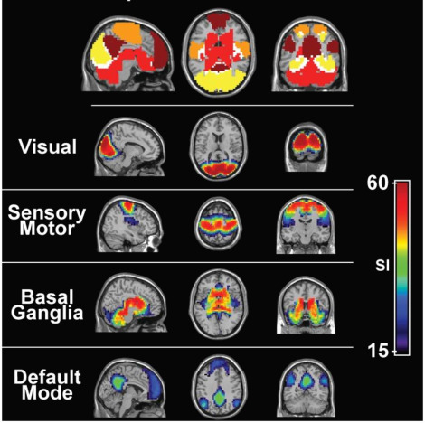 fmri image.jpg