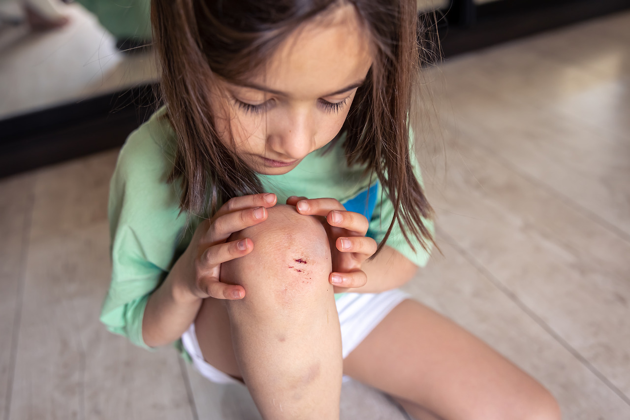 closeup-of-little-girl-holding-her-bruised-injured-damaged-knee-with-her-hands.jpg