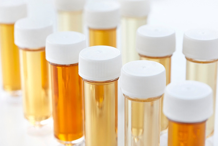 당뇨인, 소변에서 거품이 지속적으로 나온다면4.jpg