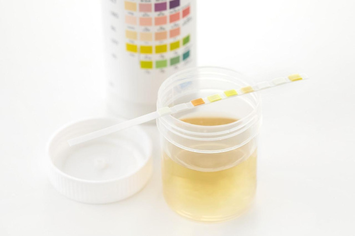 설마 이 증상도 당뇨초기증상6.jpg