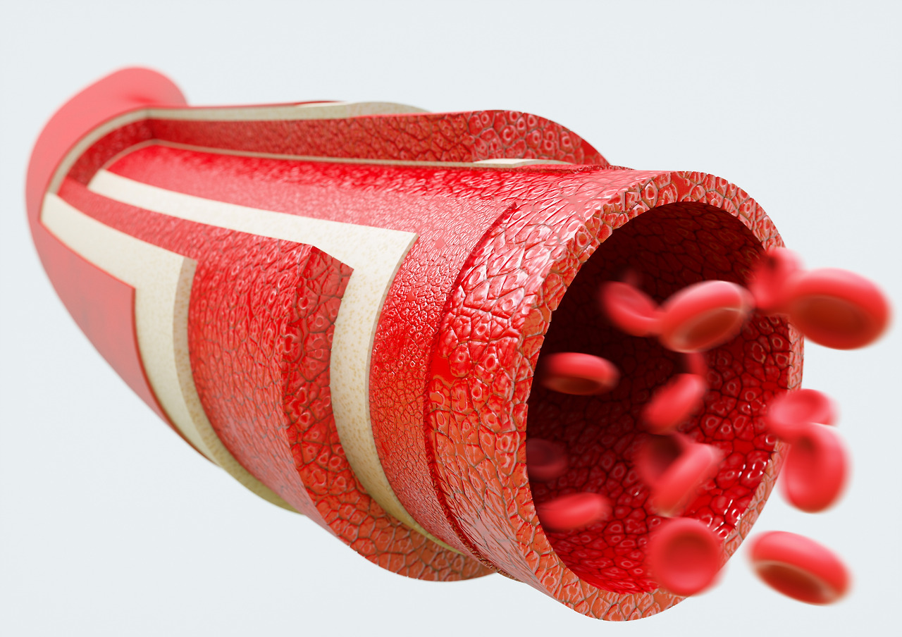 당뇨변비 (7).jpg