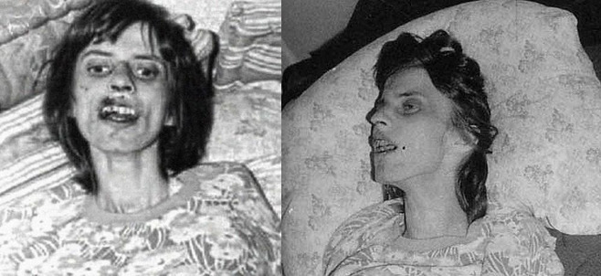 아넬리제 미헬2.jpg