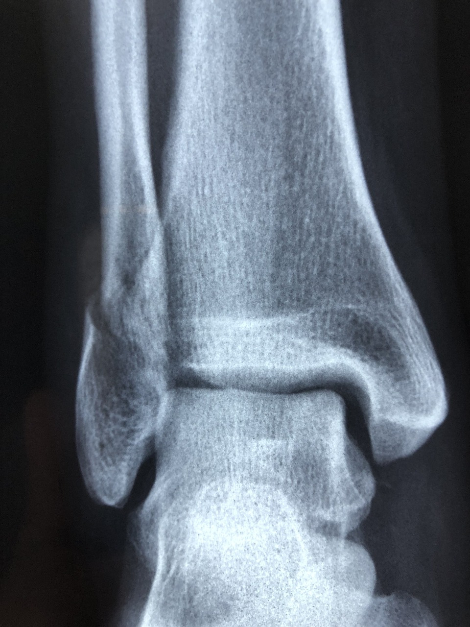 radiography-3057768_1280.jpg