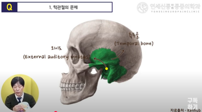 카지노 쿠폰