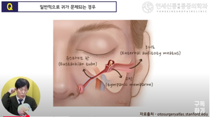 카지노 쿠폰