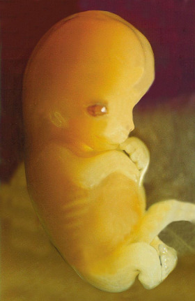 800px-Embryo_7_weeks_after_conception.jpg