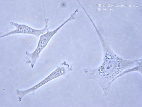 1024px-NIH_3T3.jpg