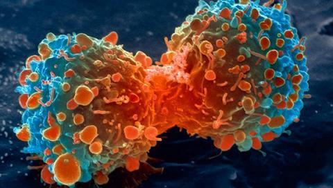 lung-cancer-cell-dividing-article___v80030169.jpg