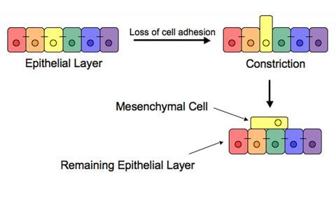 Epithelial–mesenchymal_transition_scheme.jpg