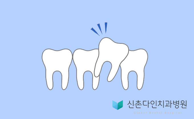 신촌다인치과_덧니.jpg