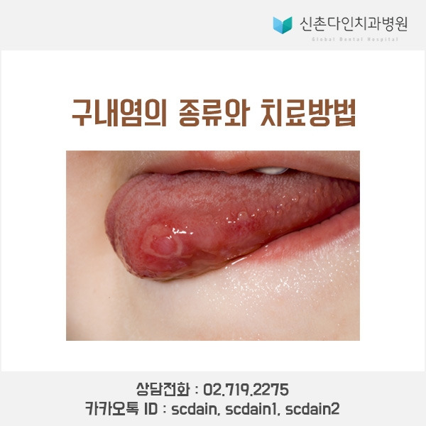 신촌_ 구내염 종류,치료 표지.jpg