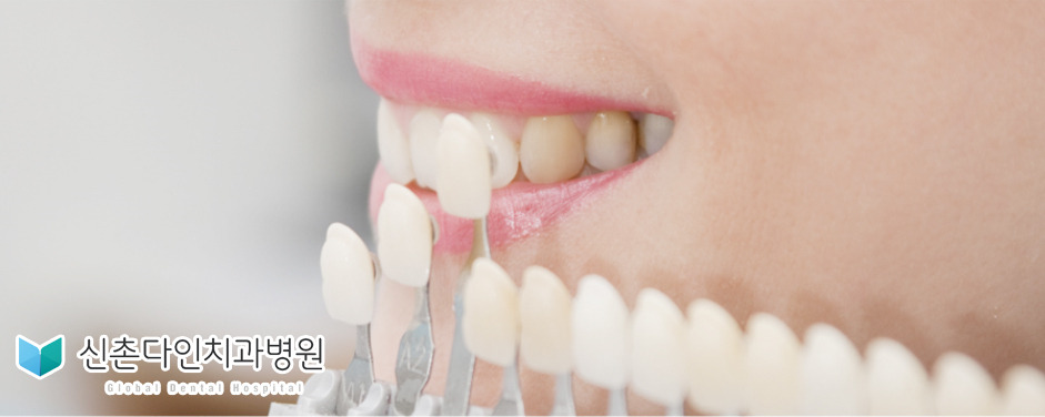신촌다인치과_치아미백.jpg