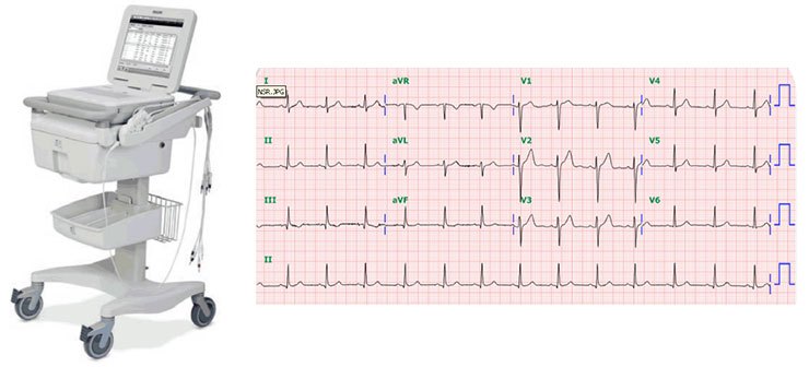 그림 3. 심전도 기계와 종이 , 출처 차움 검진센터 삼성분원.jpg