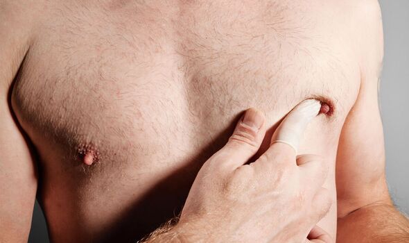 Breast-cancer-symptoms-men-4998012.jpg