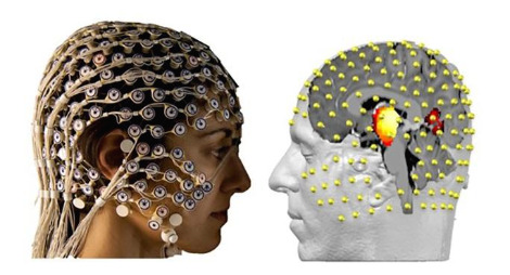EEG-deep-brain2.jpg