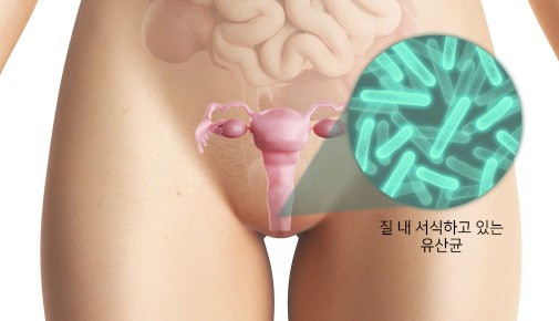 질-내-유산균.jpg