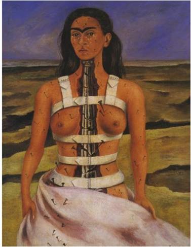 프리다 칼로_부러진 척추.jpg