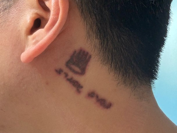 tattoo-removal procedure-IM DONG-HYUN-06.jpg